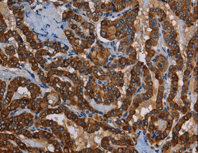 PIDD1 Antibody