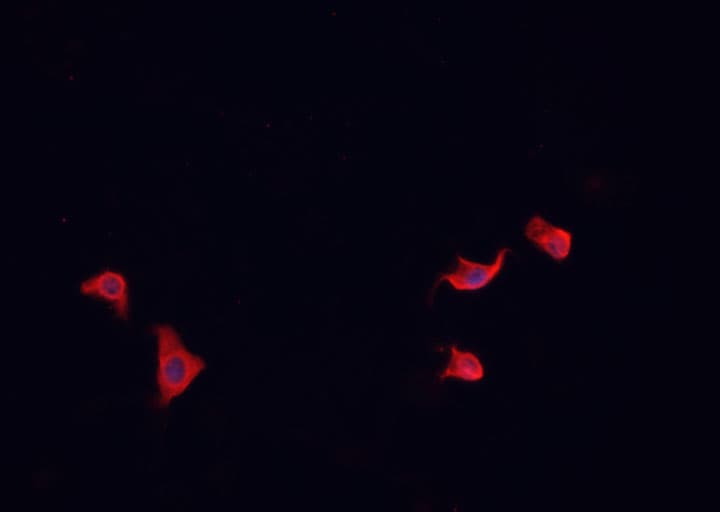NGFR / CD271 / TNR16 Antibody