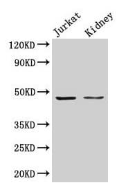 ALDOA / Aldolase A Antibody