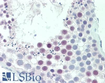 IHC-plus™ Polyclonal Rabbit anti-Human RFX4 Antibody (aa684-720, IHC, WB)