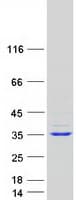 Human TTC33 Protein (Recombinant Myc-DDK (Flag))