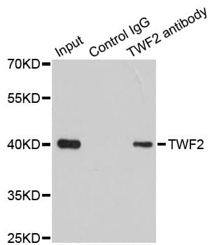 Polyclonal Rabbit anti-Human TWF2 / PTK9L Antibody (IHC, WB)