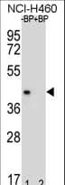 MBP / Myelin Basic Protein Antibody (Tyr203)