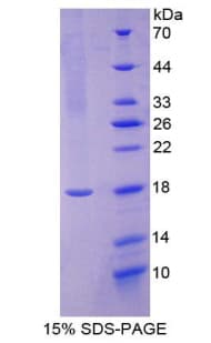 Human CGB / hCG Beta Protein (Recombinant His-T7)
