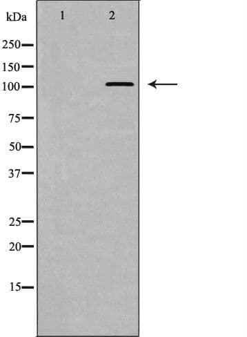EPHA3 / EPH Receptor A3 Antibody