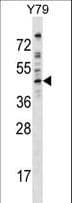 DMTN / Dematin Antibody (aa249-277)