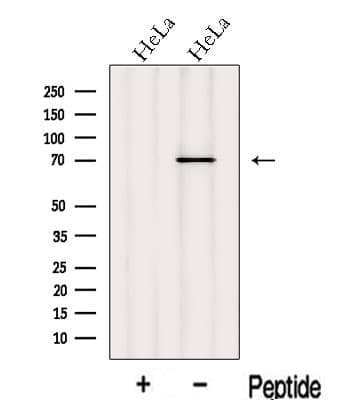 INPP5B Antibody