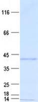 Human CSNK1A1 / CK1 Alpha Protein (Recombinant His, N-Terminal)