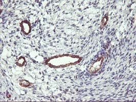 FAM84B Antibody (clone OTI1D12)