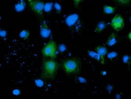 ADH2 / ADH1B Antibody (clone OTI1H7)