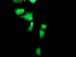 FBXO21 Antibody (clone OTI4G5)