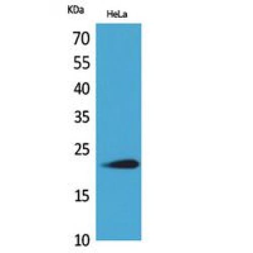 IFNW / Interferon Omega Antibody (143-192 aa, C-terminal)