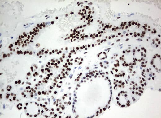 Monoclonal Mouse anti-Human ZSCAN18 / ZNF447 Antibody (clone UMAB114, IHC, WB)