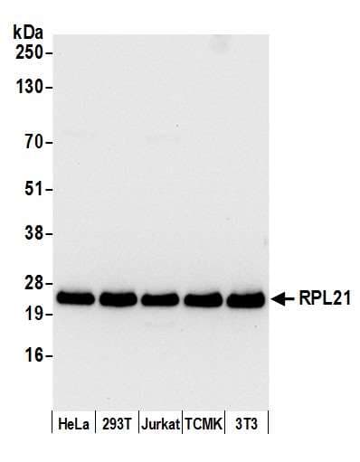 RPL21 / Ribosomal Protein L21 Antibody (aa1-50)