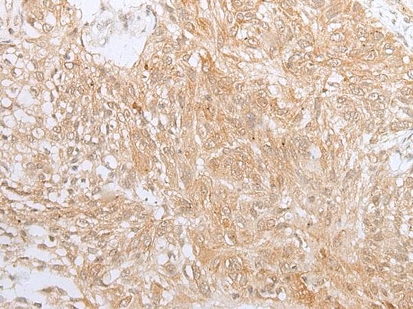 Polyclonal Rabbit anti-Human ZNF34 Antibody (IHC)