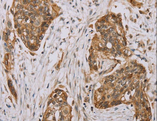 MVK Antibody