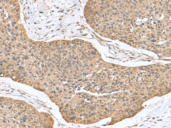 CSRP2 Antibody