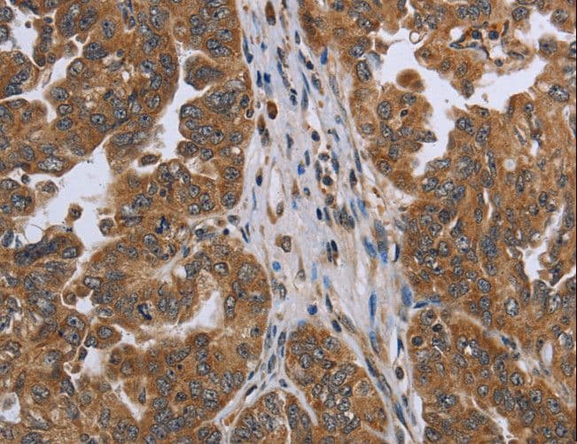 C6orf66 Antibody