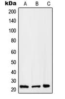 Polyclonal Rabbit anti-Human RAB2B Antibody (Internal, WB)
