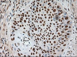NOTCH1 Antibody (clone OTI3E12)