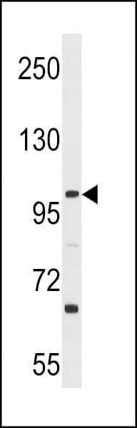 L3MBTL3 Antibody (aa90-116)