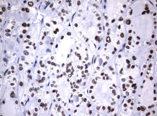 NBN / Nibrin Antibody (aa461-754, clone UMAB99)