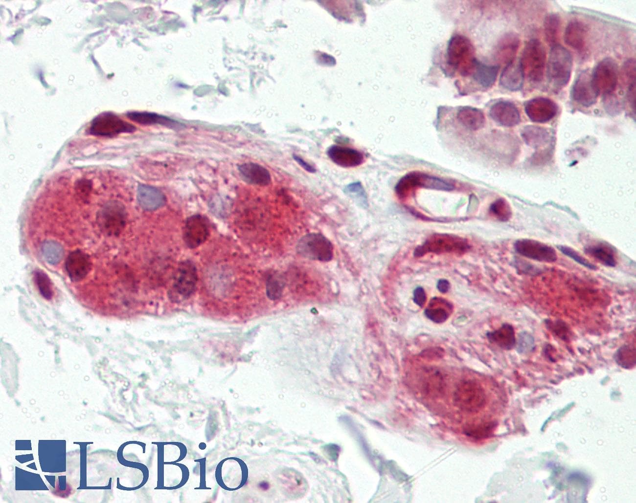 IHC-plus™ Polyclonal Rabbit anti-Human CDC37 Antibody (aa1-50, IHC, IF, WB)