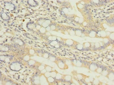 Polyclonal Rabbit anti-Human NUPL1 Antibody (aa211-480, IHC, WB)