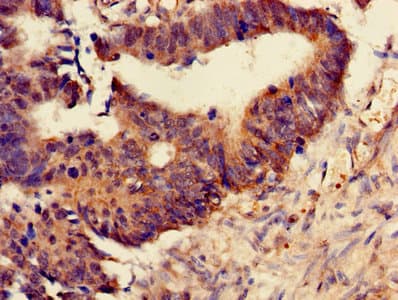 PSMB4 Antibody