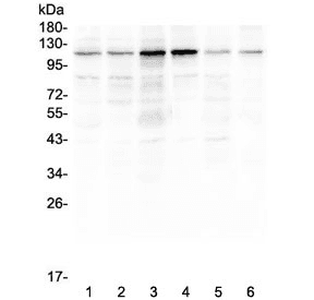 Smoothelin Antibody