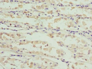 CAPNS1 / CAPN4 Antibody