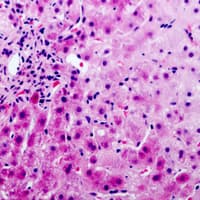 Polyclonal Rabbit anti-Human SERPINA5 / PCI Antibody (Internal, IHC, WB)