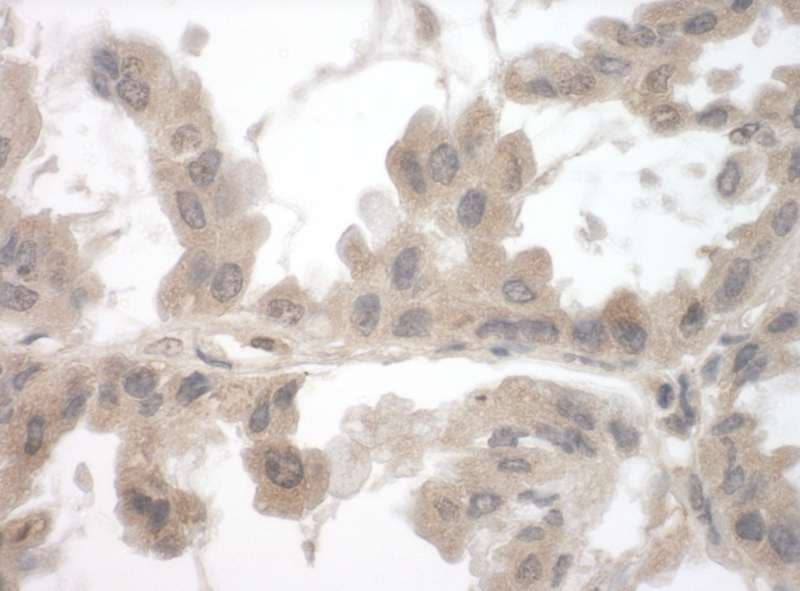 Polyclonal Rabbit anti-Human TOCA1 / FNBP1L Antibody (aa450-500, IHC, WB)