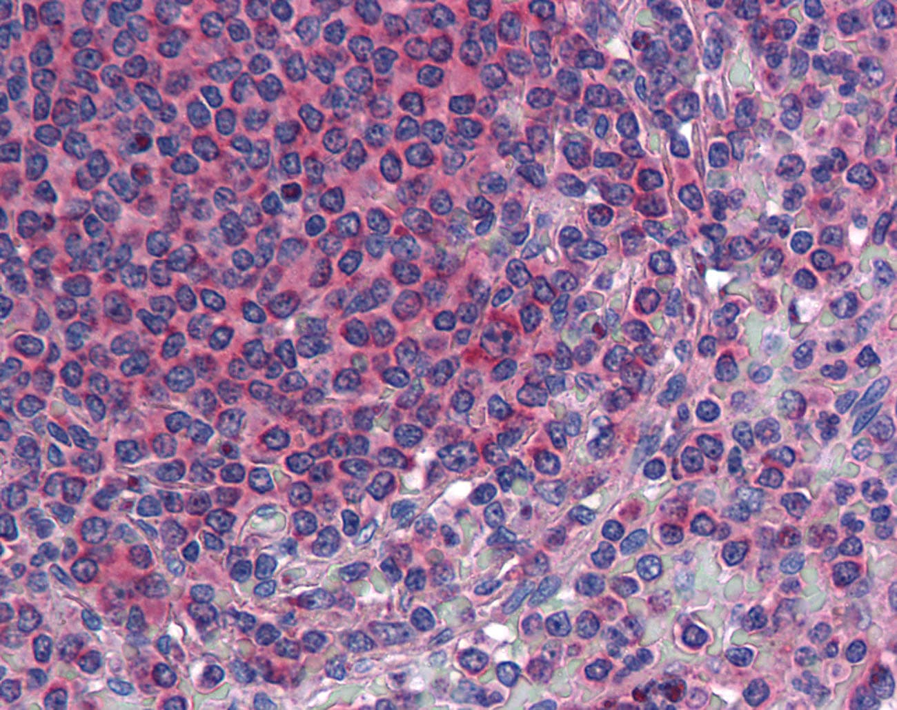 IHC-plus™ Polyclonal Rabbit anti-Human TM9SF3 Antibody (Internal, IHC)