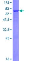 Human ADH7 Protein (Recombinant GST)