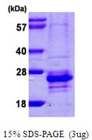 Human CABP7 Protein (Recombinant His)