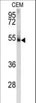 PRKAR1A Antibody (aa1-30)