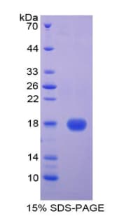 Human CST5 Protein (Recombinant His-T7)