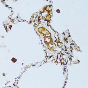 Polyclonal Rabbit anti-Human C1QG / Complement C1QC Antibody (IHC)