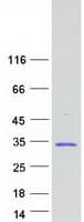 Human EIF6 Protein (Recombinant Myc-DDK (Flag))