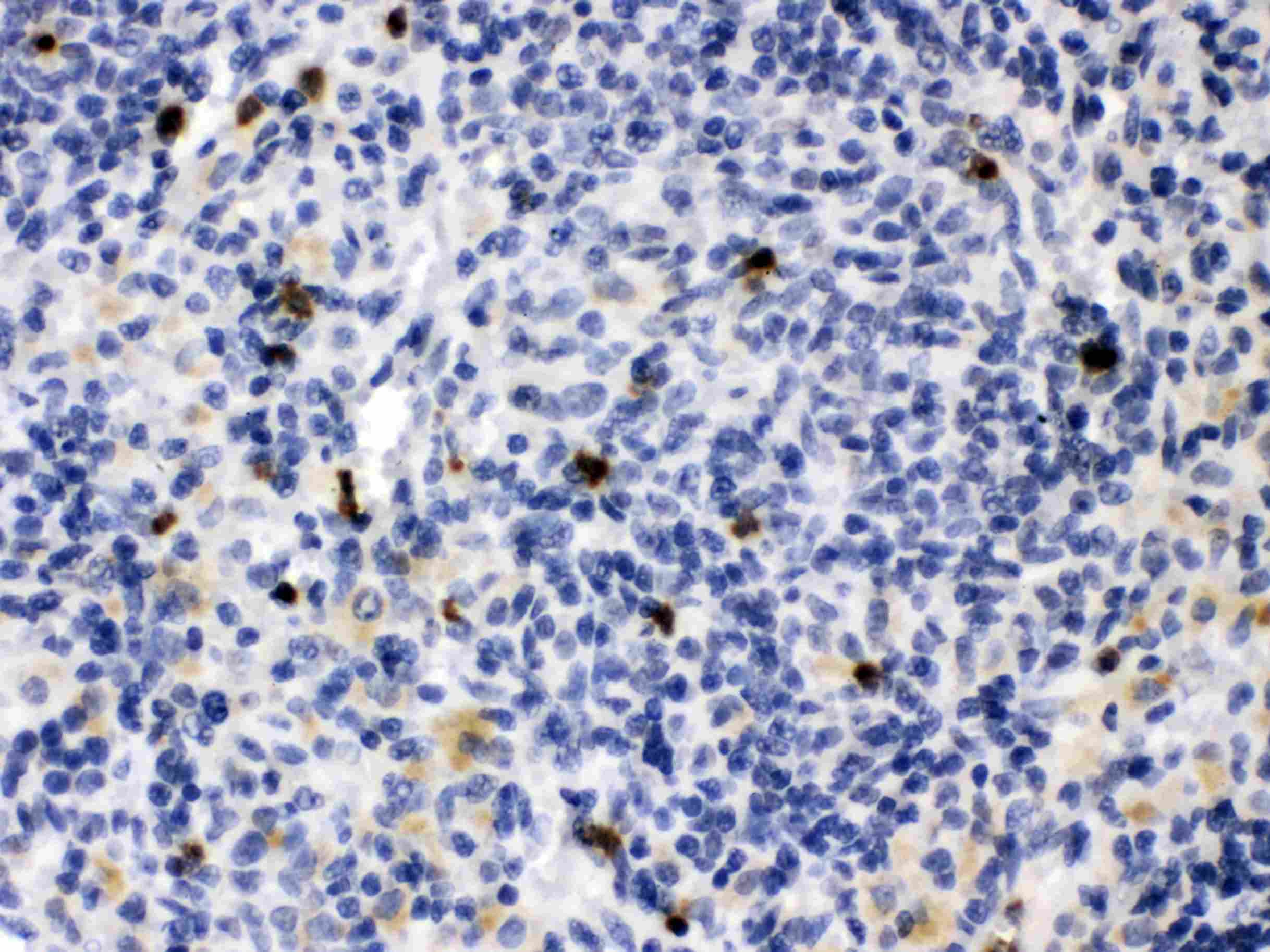 MMP9 / Gelatinase B Antibody