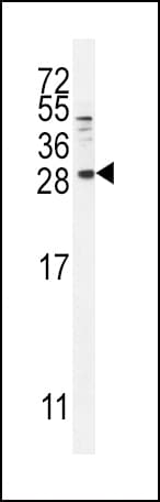 BTC / Betacellulin Antibody (aa17-45)