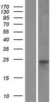 VMO1 Protein (Over-Expression Lysate Myc-DDK (Flag))