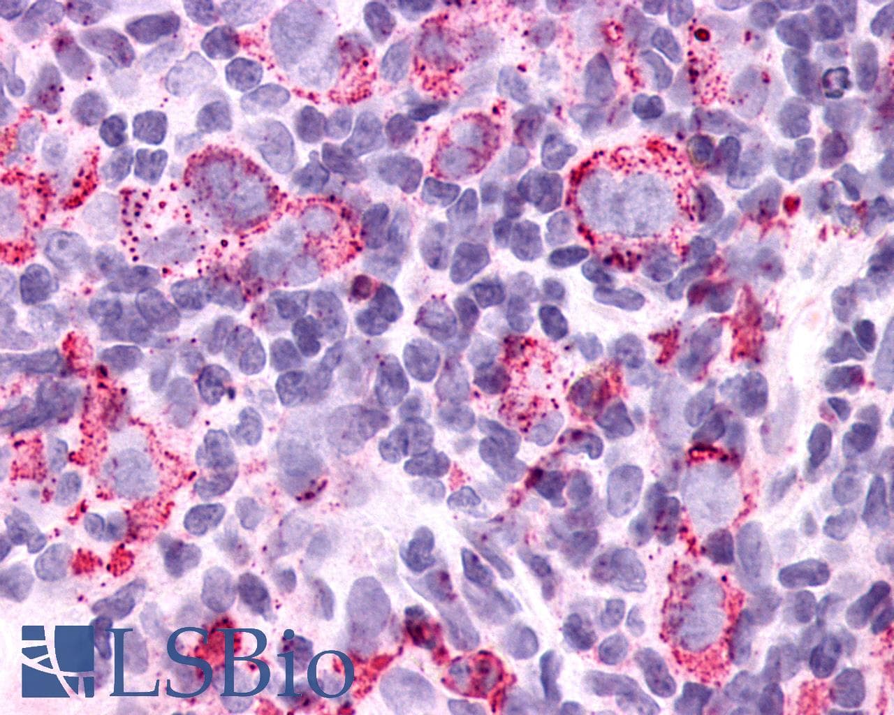 PathPlus™ Polyclonal Rabbit anti-Human GPR34 Antibody (Cytoplasmic Domain, IHC)
