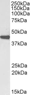 PathPlus™ ACTA2 / Smooth Muscle Actin Antibody (aa1-50)