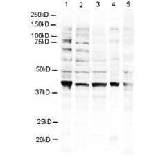IHC-plus™ RNF2 / RING2 / RING1B Antibody (aa189-201)