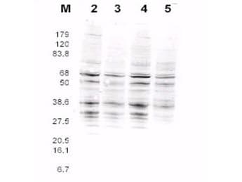 Yeast Rfa2 Antibody