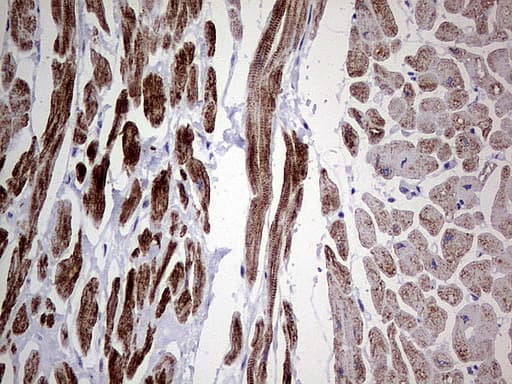 DES / Desmin Antibody (clone UMAB166, Carrier-free)