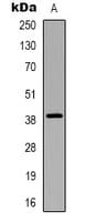 CHST13 Antibody (Internal)