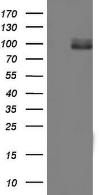 Monoclonal Mouse anti-Human MDM2 Antibody (clone OTI8F7, aa119-438, WB)